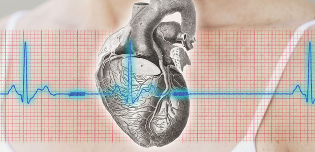 After a Heart Attack