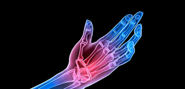 Common Arthritis Questions Answered