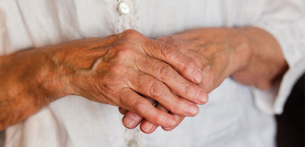 Rheumatoid Arthritis and Osteoarthritis