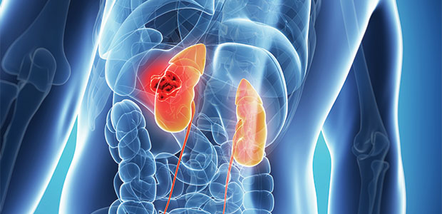 Care For Your Kidneys