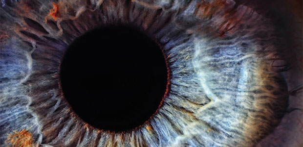 Something in Your Eye?