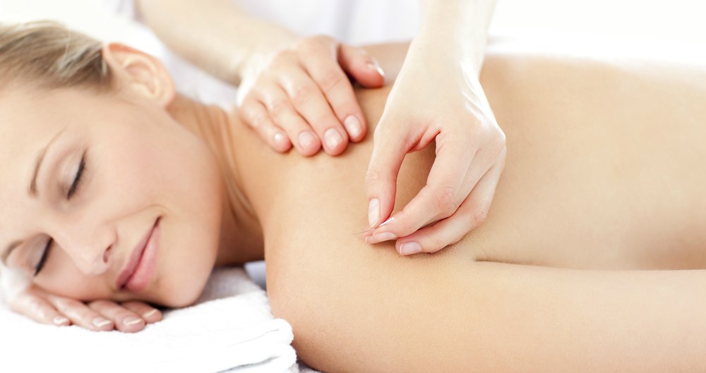 Got Stress? Try Acupuncture