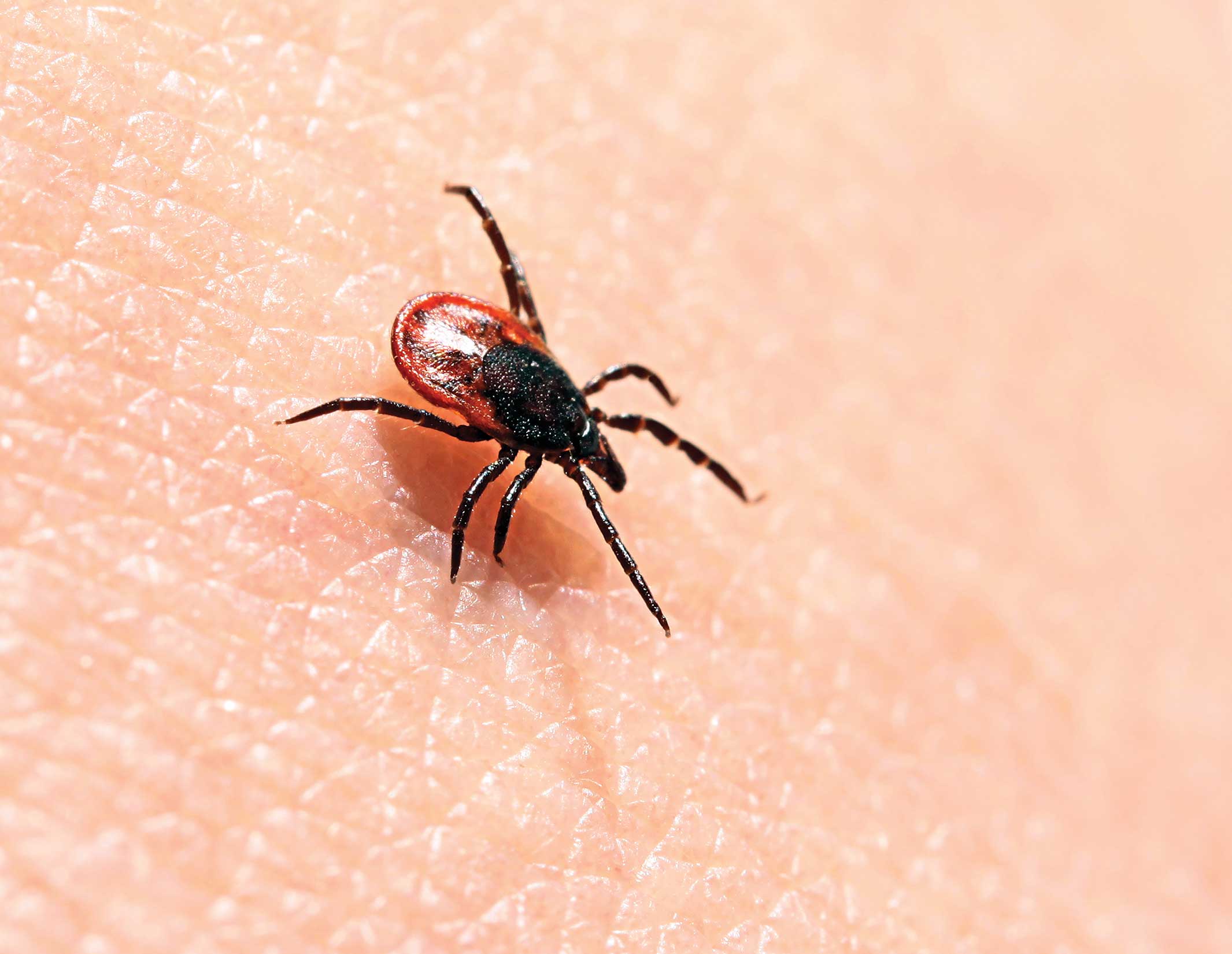 The Growing Threat of Lyme Disease